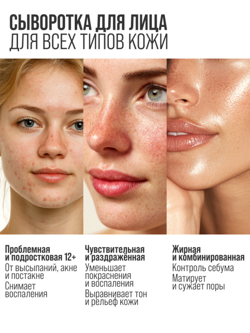 Сыворотка для лица от прыщей B3 2%+ZN 0,5%